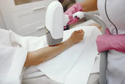 Laser Hair Removal